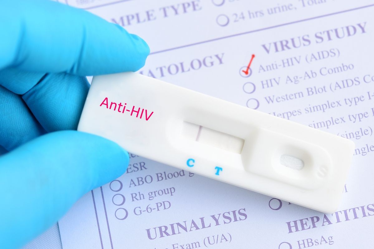 HIV negative test result by using rapid test cassette