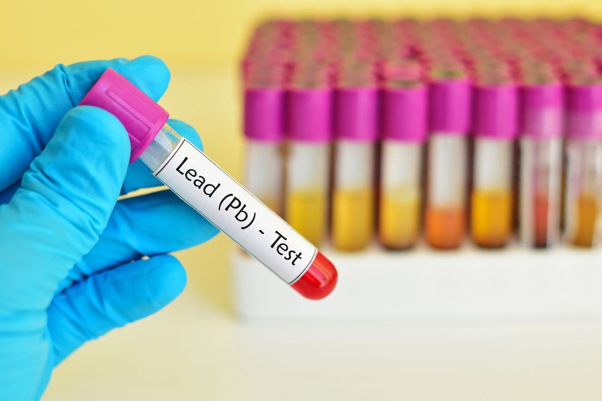 Test tube with blood sample for lead (Pb) metal test