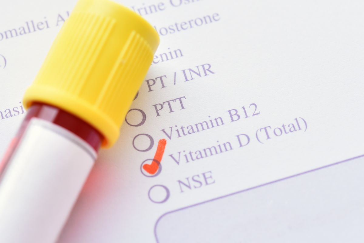 Test tube with blood sample for vitamin D test